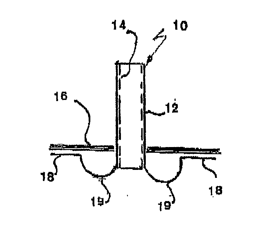 Ear tubes