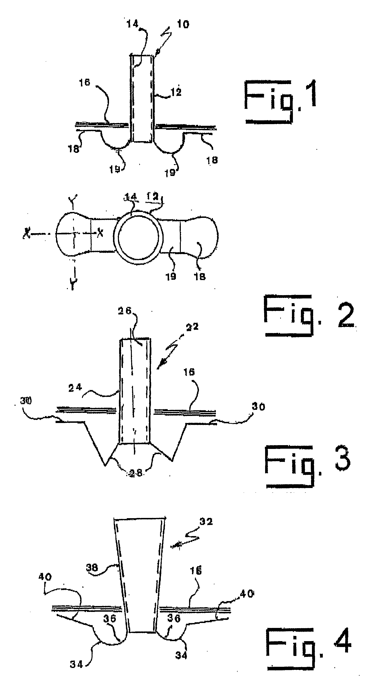 Ear tubes