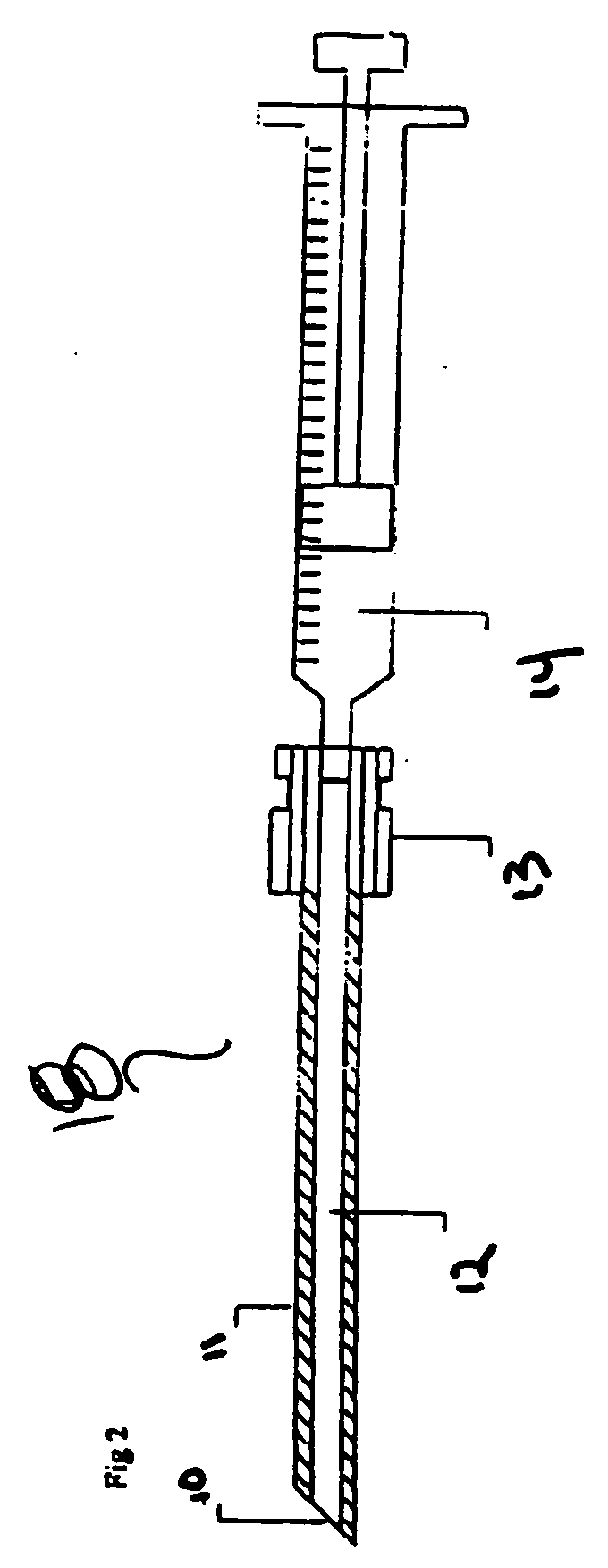 Percutaneous diagnostic and therapeutic hematoma drain