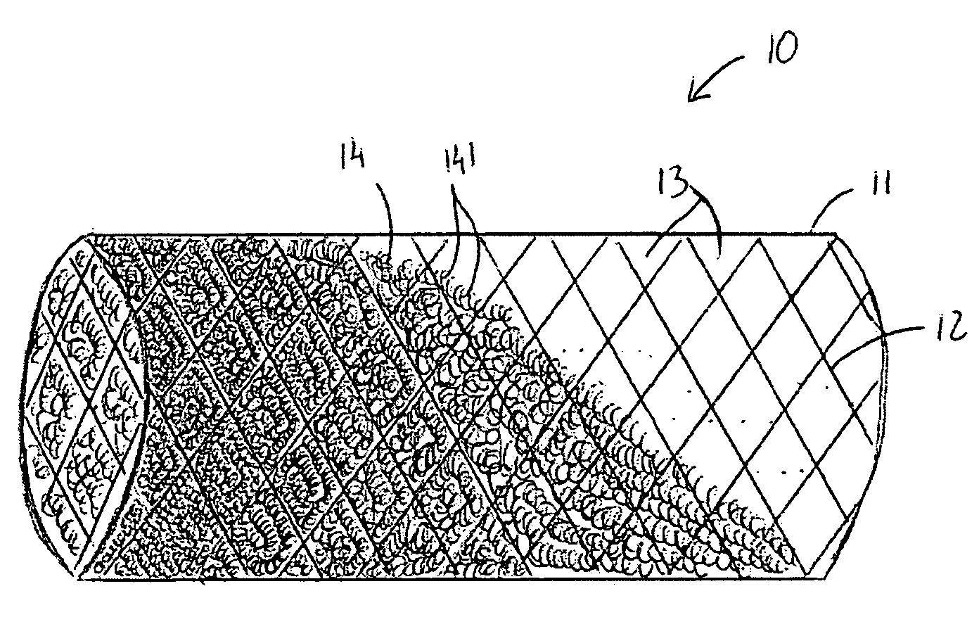 Intravascular device with netting system