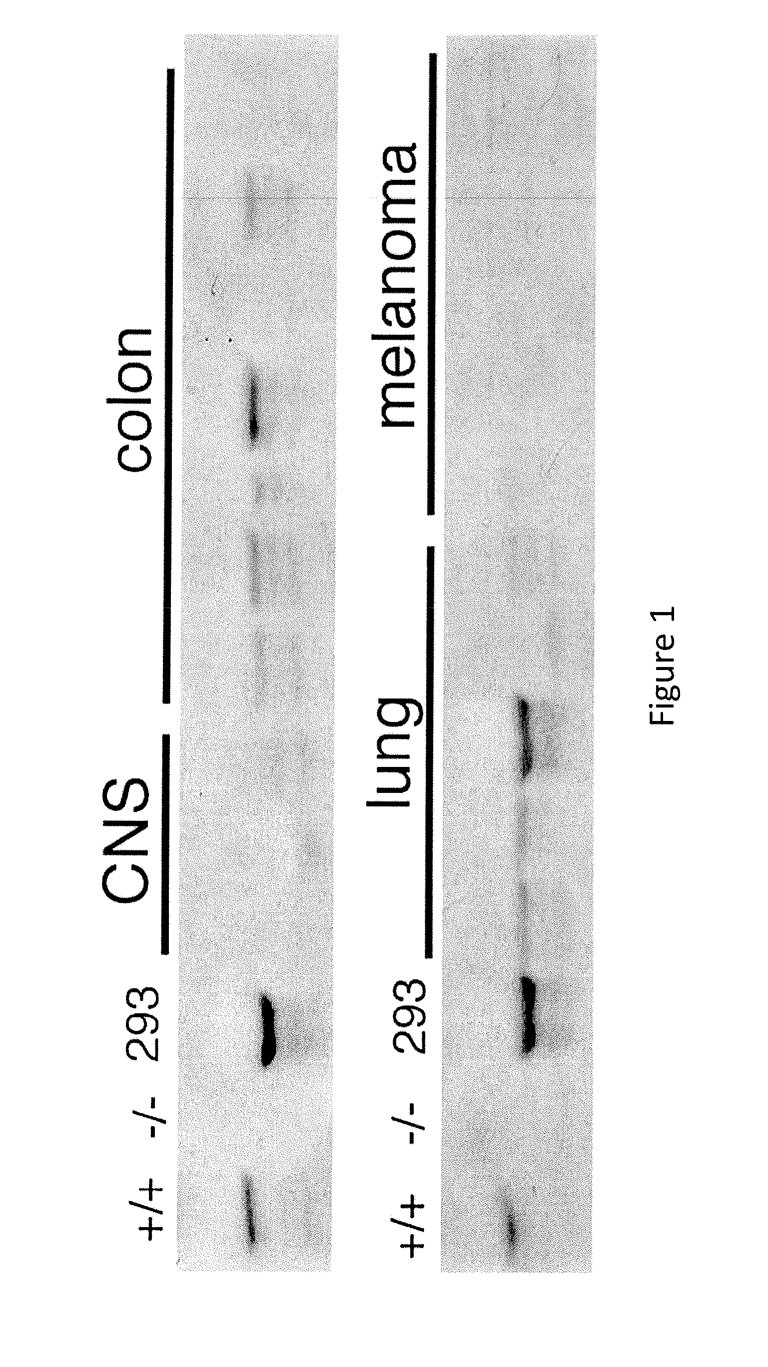 Inhibition of Thymine DNA Glycosylase in the Treatment of Cancer