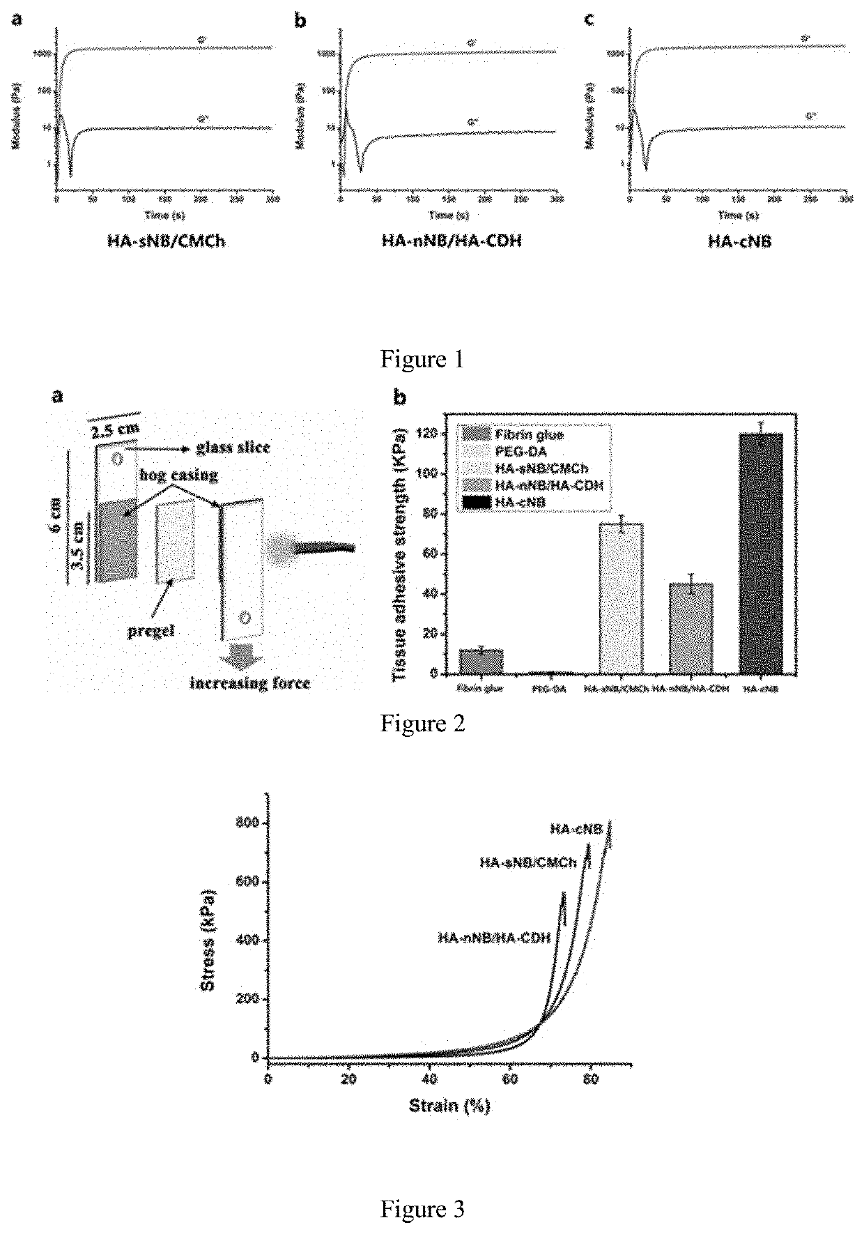 Photo-coupled synergistically crosslinked hydrogel material and its composition, preparation method, use, product, and preparation kit