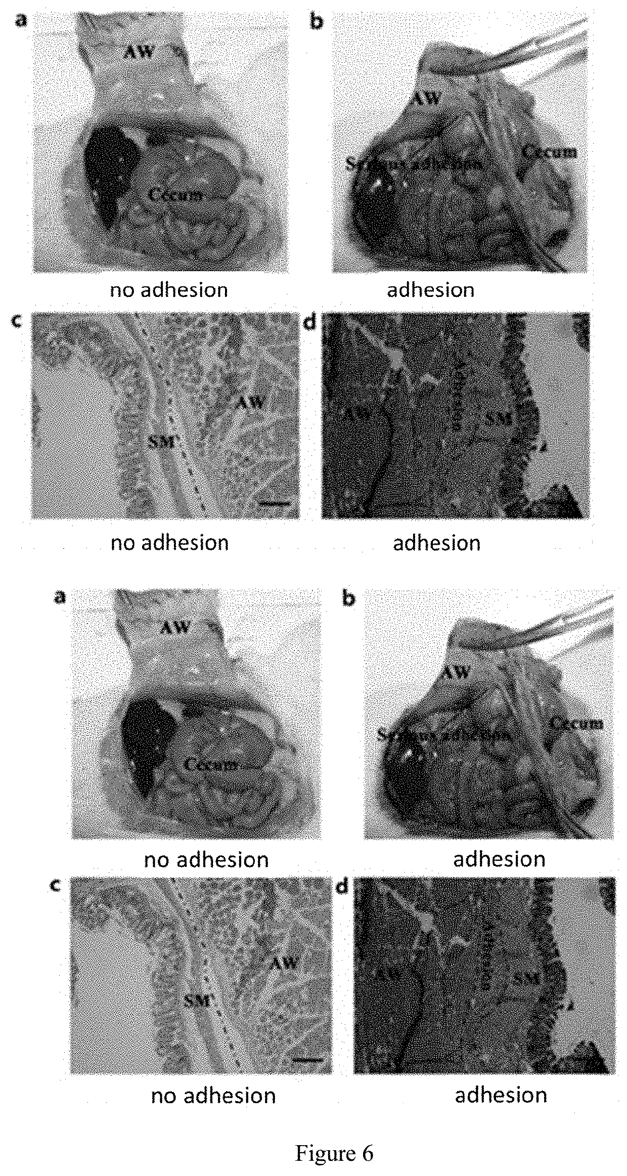 Photo-coupled synergistically crosslinked hydrogel material and its composition, preparation method, use, product, and preparation kit