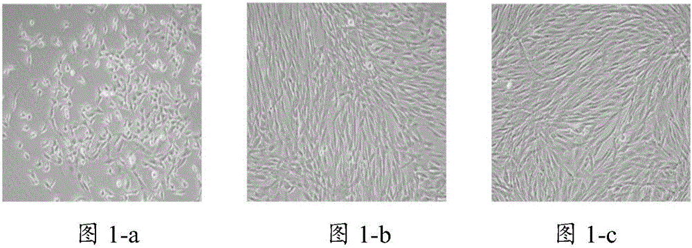 Cell culture fluid, application thereof and method for inducing periodontal ligament stem cells to differentiate into myocardium-like cells