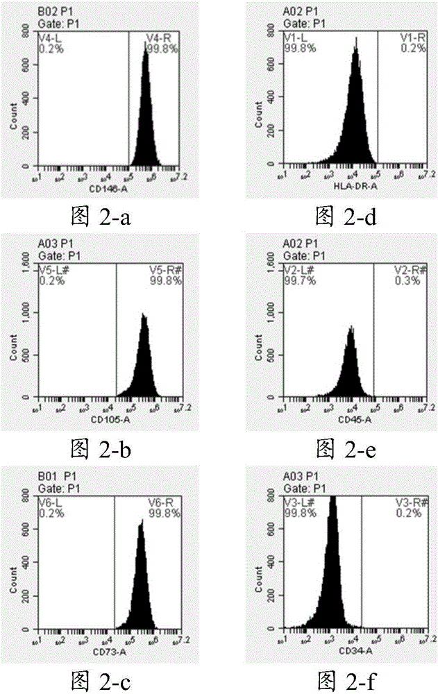 Cell culture fluid, application thereof and method for inducing periodontal ligament stem cells to differentiate into myocardium-like cells