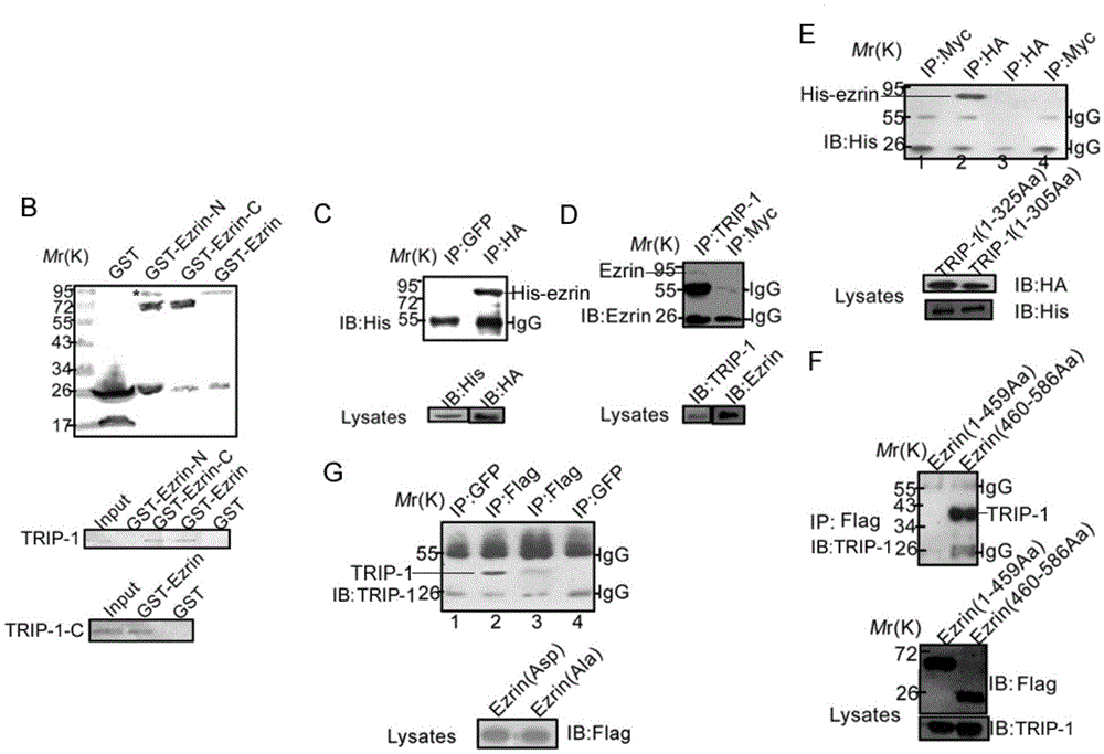 Uses of tgf-beta receptor binding protein-1