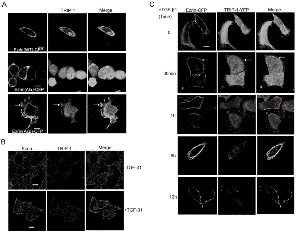 Uses of tgf-beta receptor binding protein-1