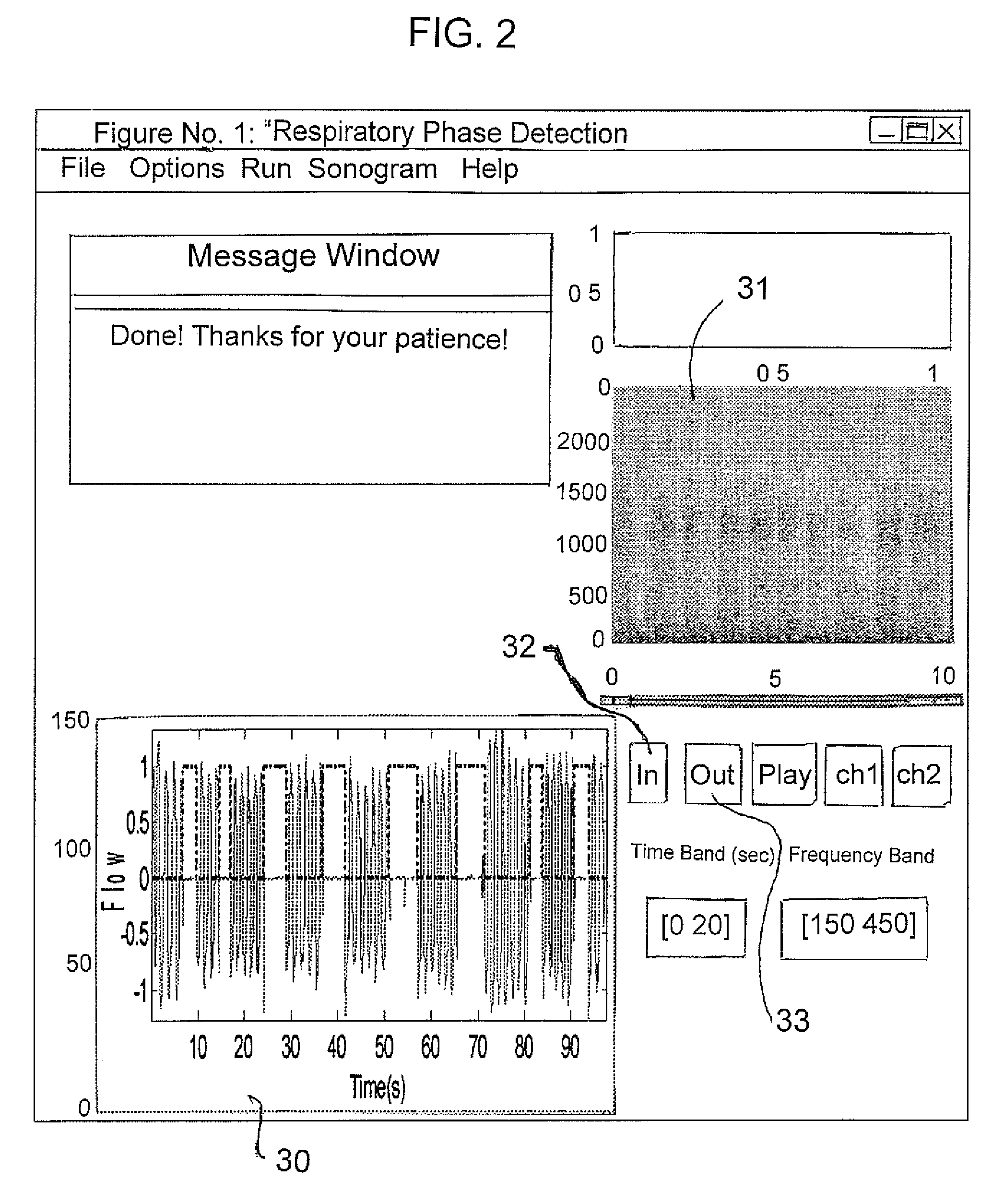 Breathing sound analysis for detection of sleep apnea/popnea events