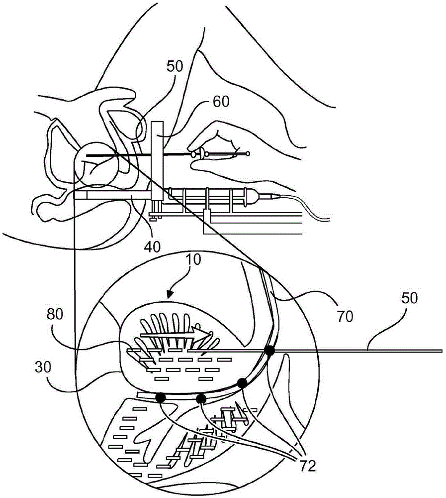 Method and system for localizing body structures