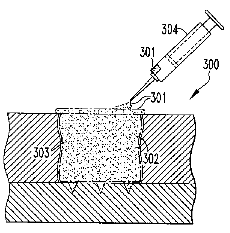 Methods of Regenerating Cartilage