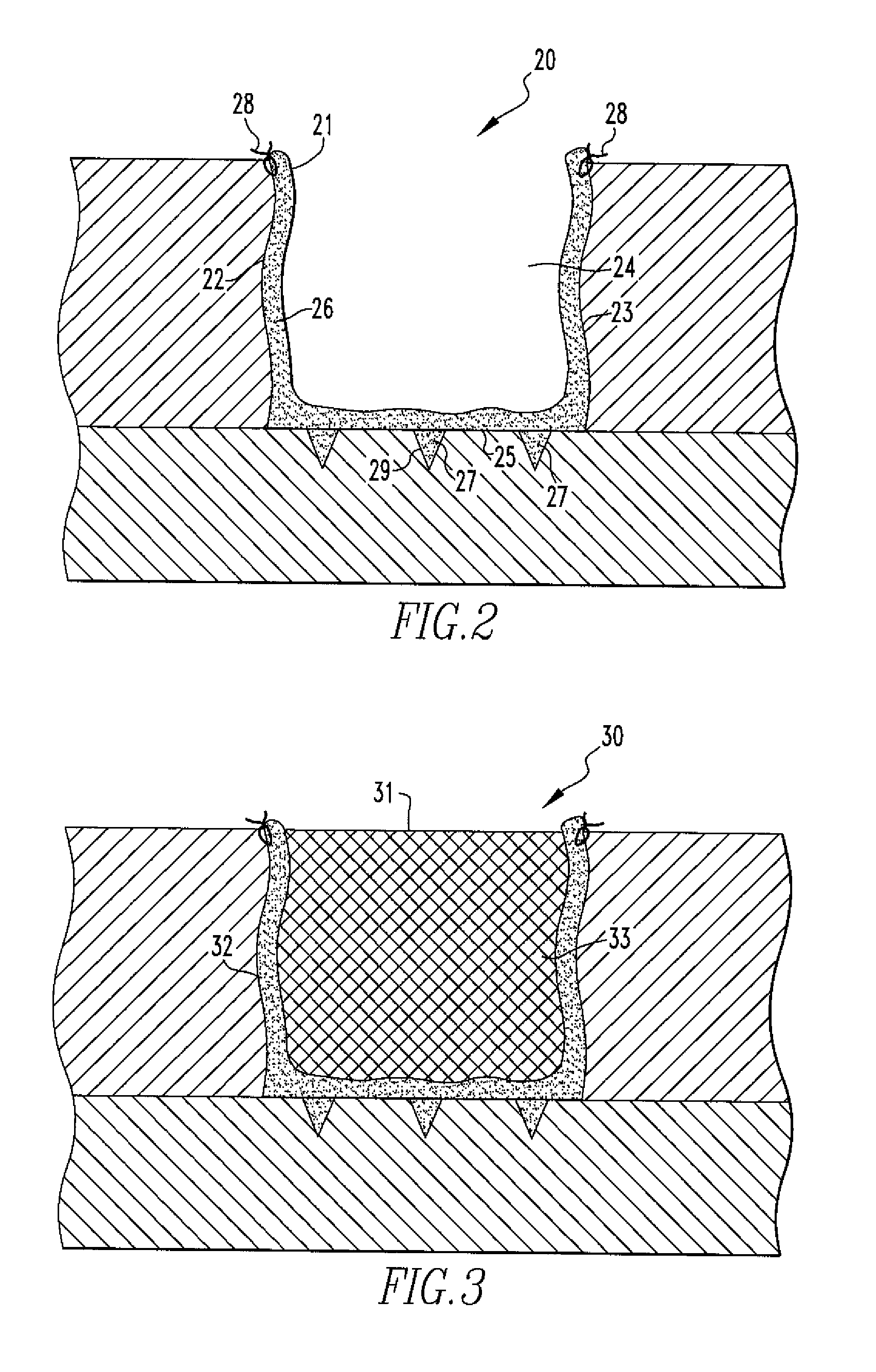 Methods of Regenerating Cartilage