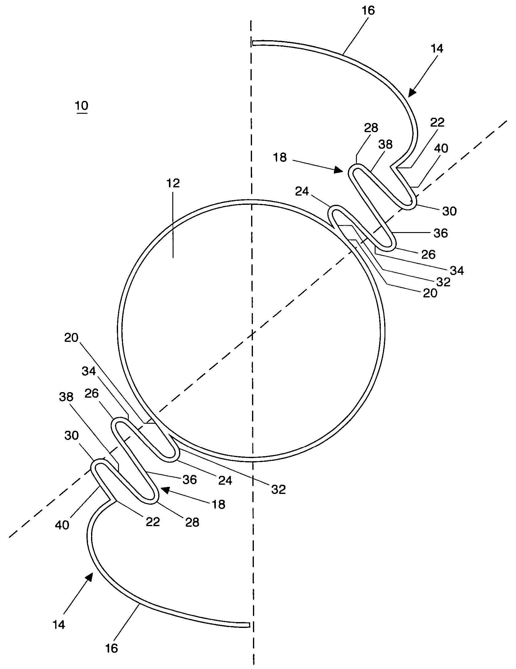 Accommodating intraocular lens implant