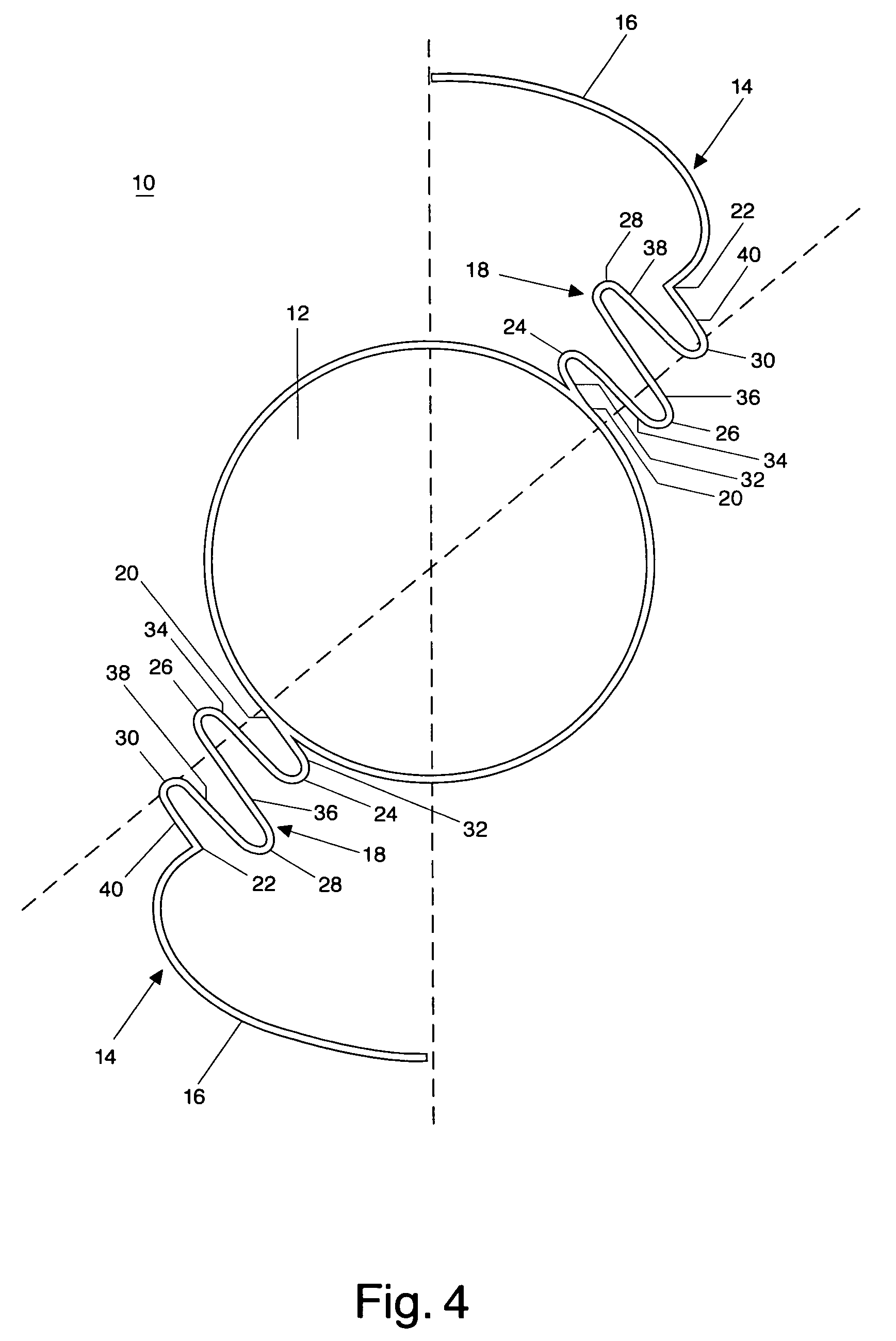 Accommodating intraocular lens implant