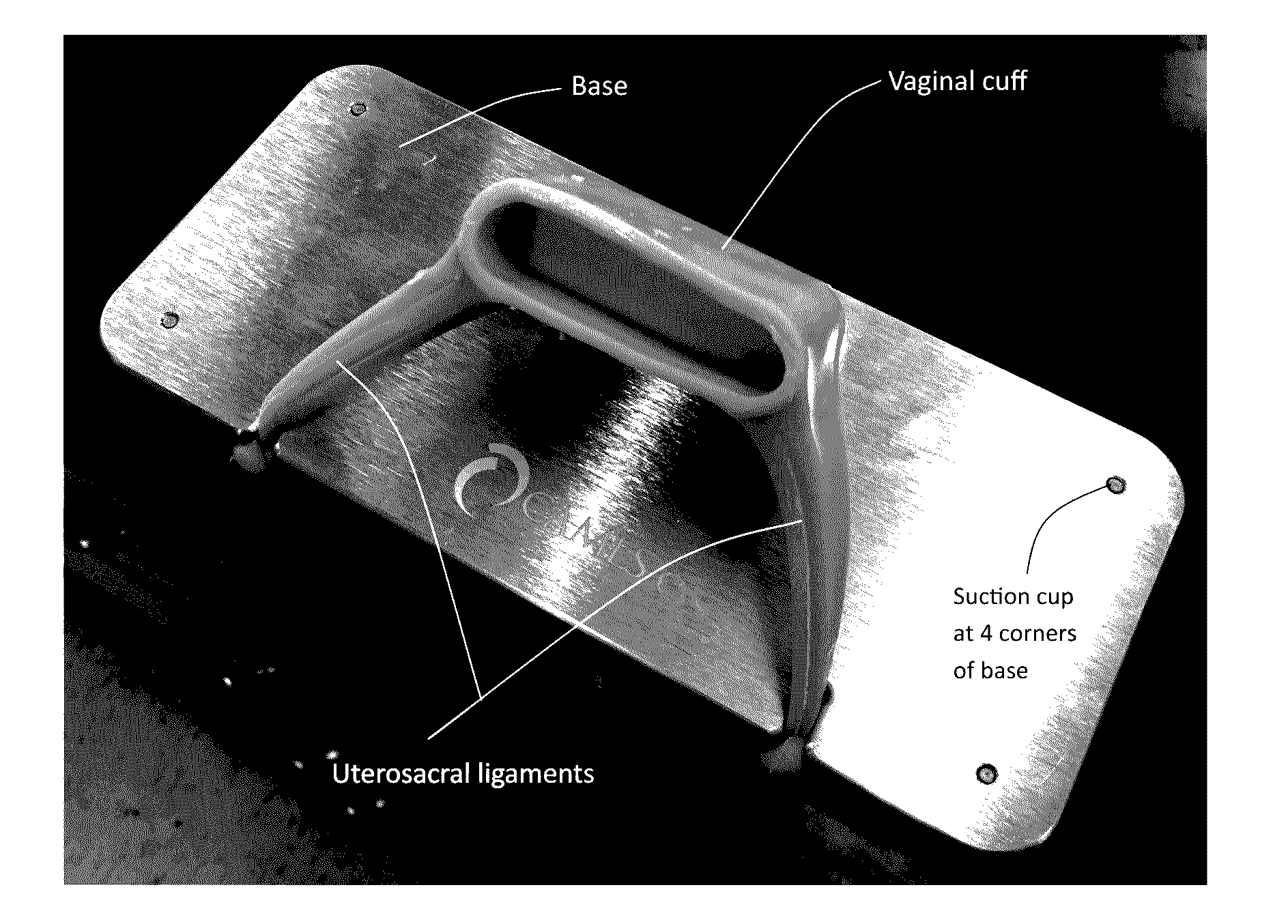 Synthetic vaginal cuff model and method of simulating vaginal cuff closure