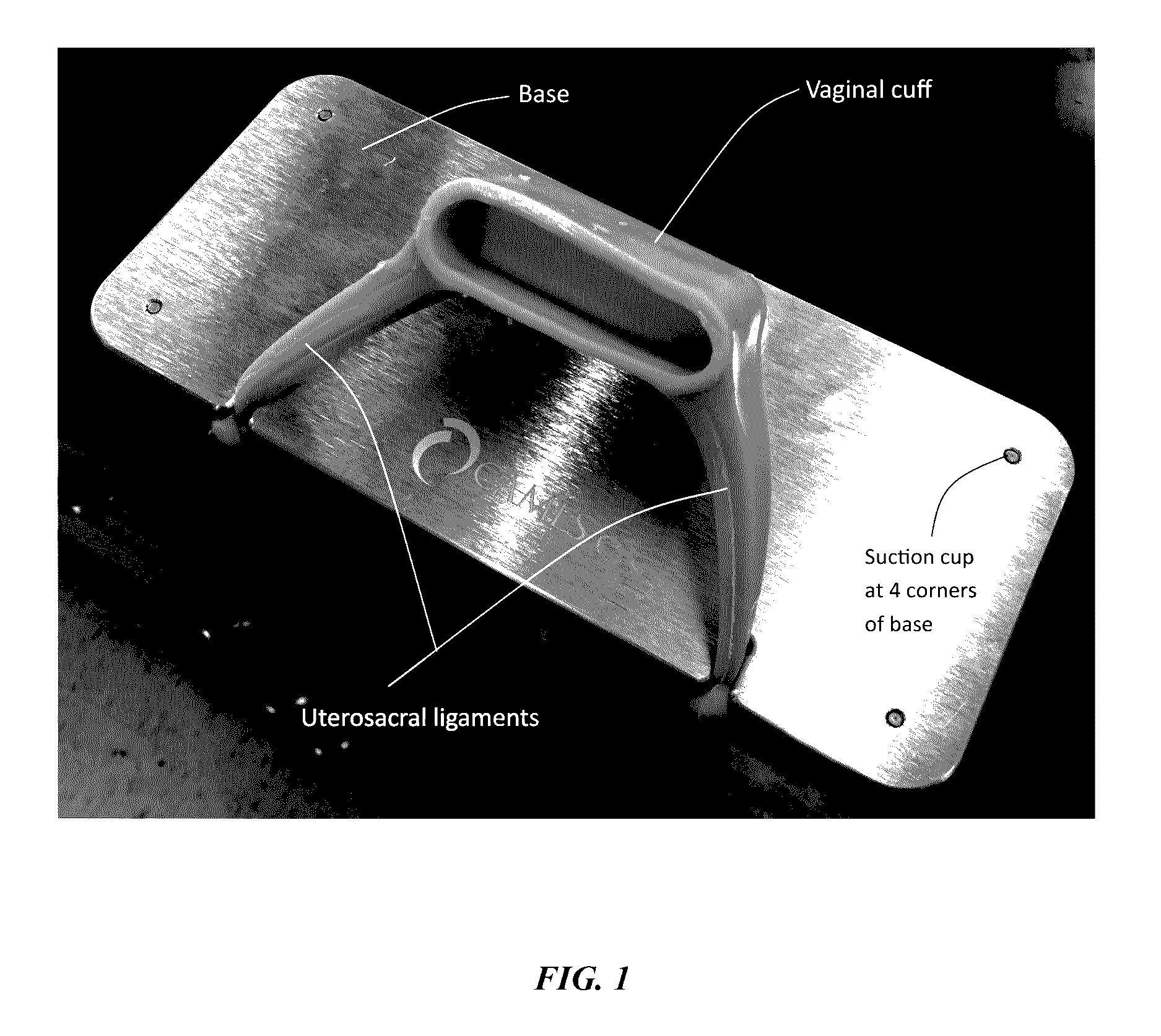 Synthetic vaginal cuff model and method of simulating vaginal cuff closure