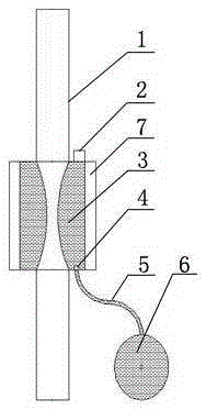 A ventriculo-peritoneal cerebrospinal fluid shunt device