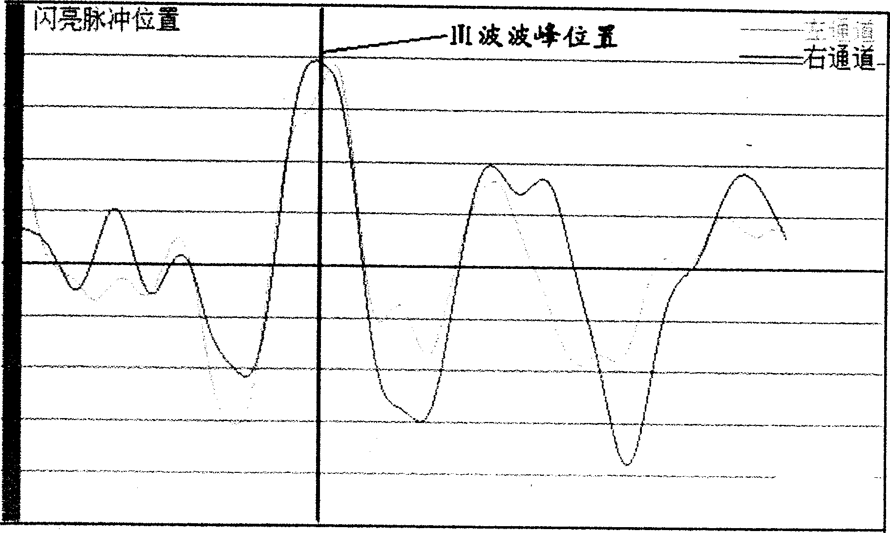 Wound-frce intracranial pressure monitoring method and apparatus