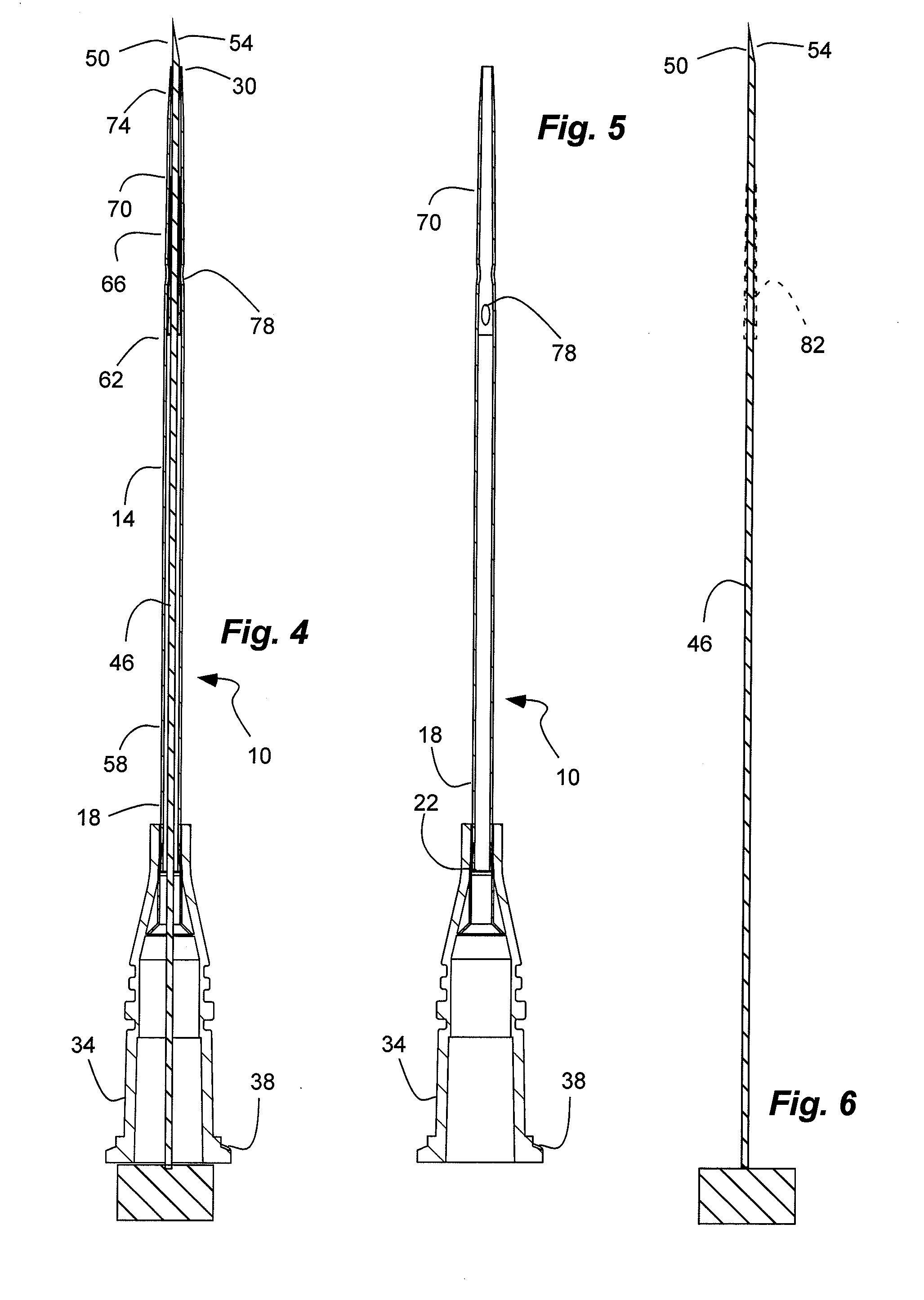 High-flow tapered peripheral iv catheter with side outlets