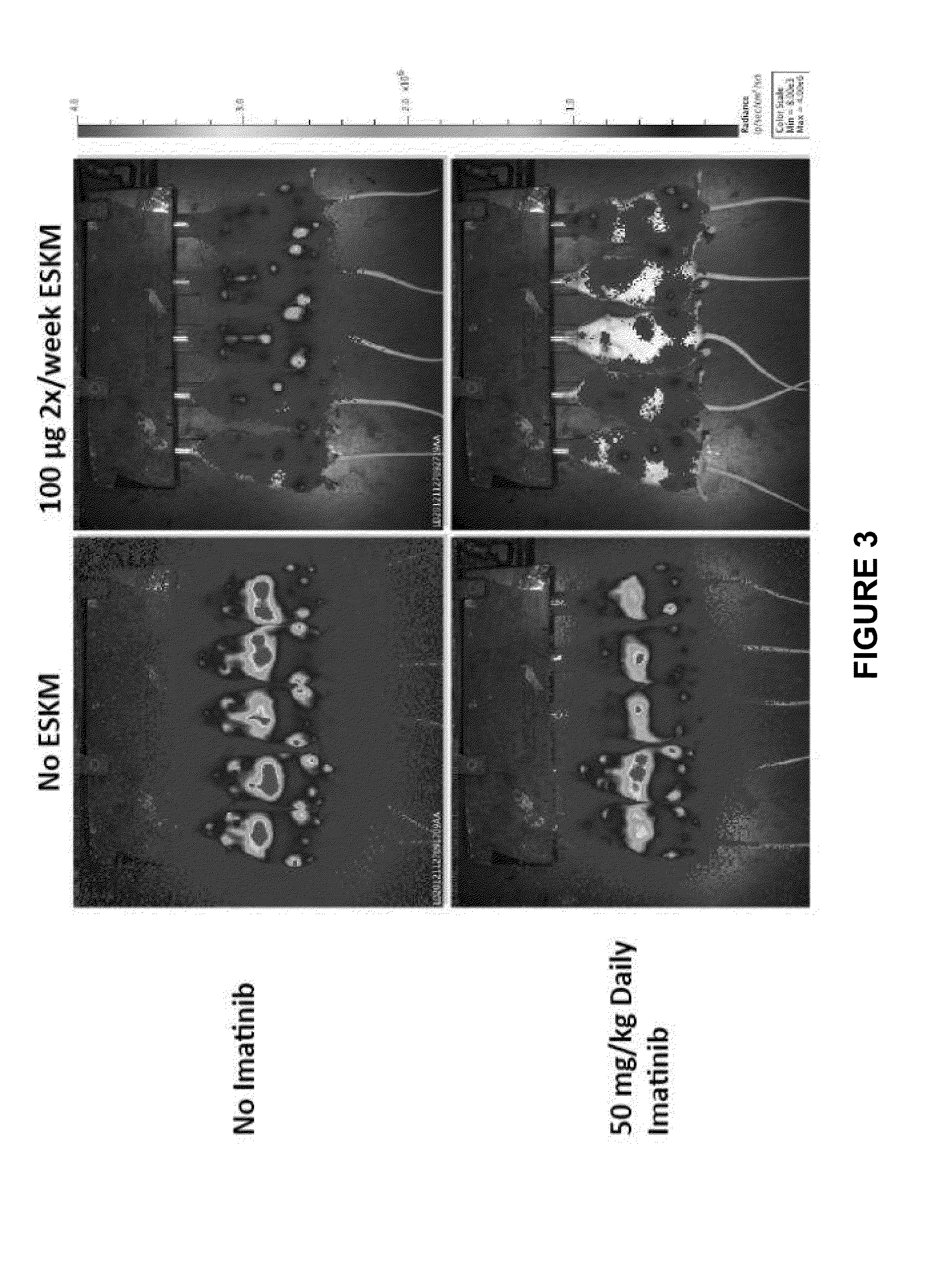 Combination/adjuvant therapy for wt-1-positive disease