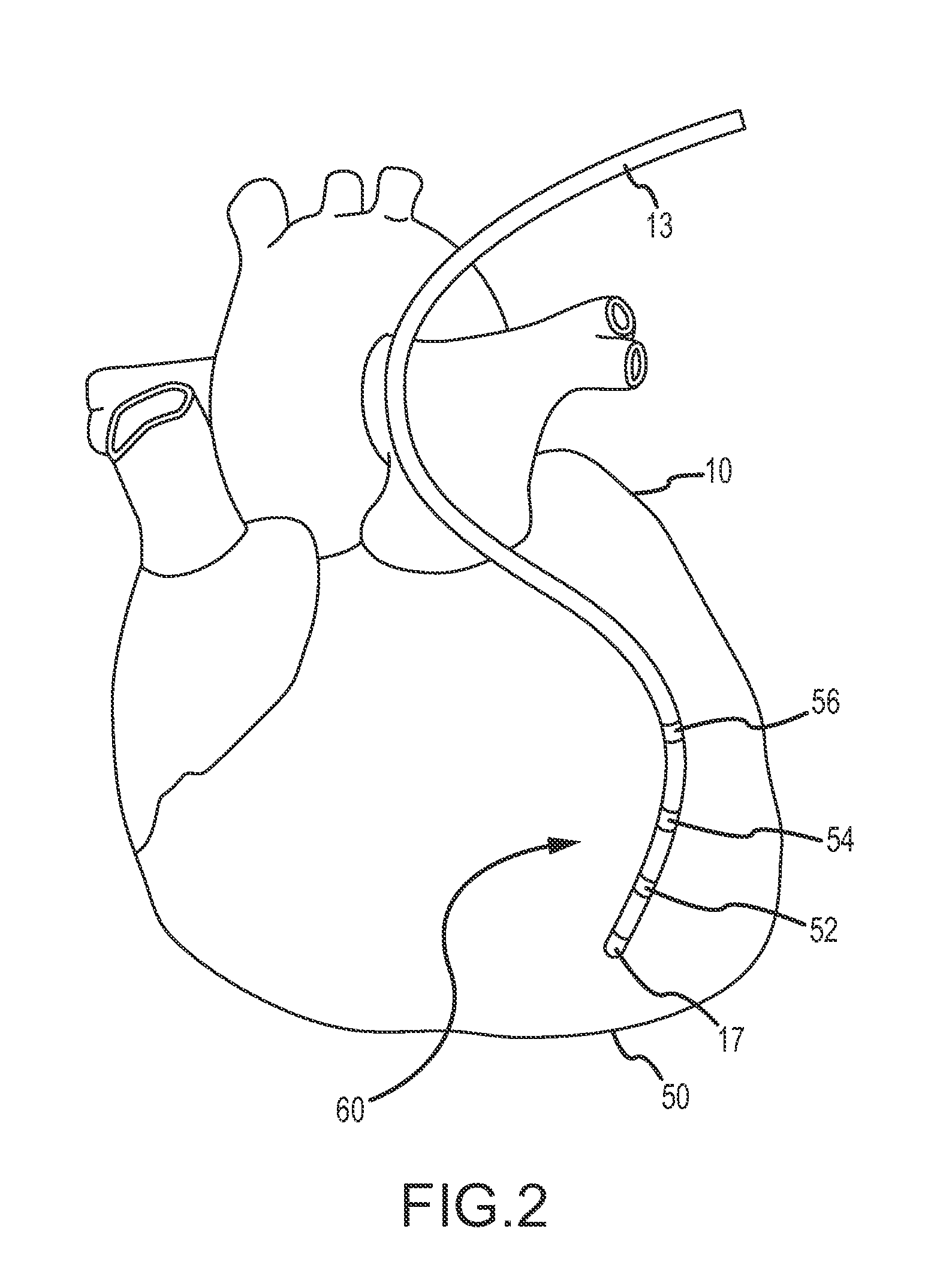 Methods and Apparatus for Detecting and Mapping Tissue Interfaces