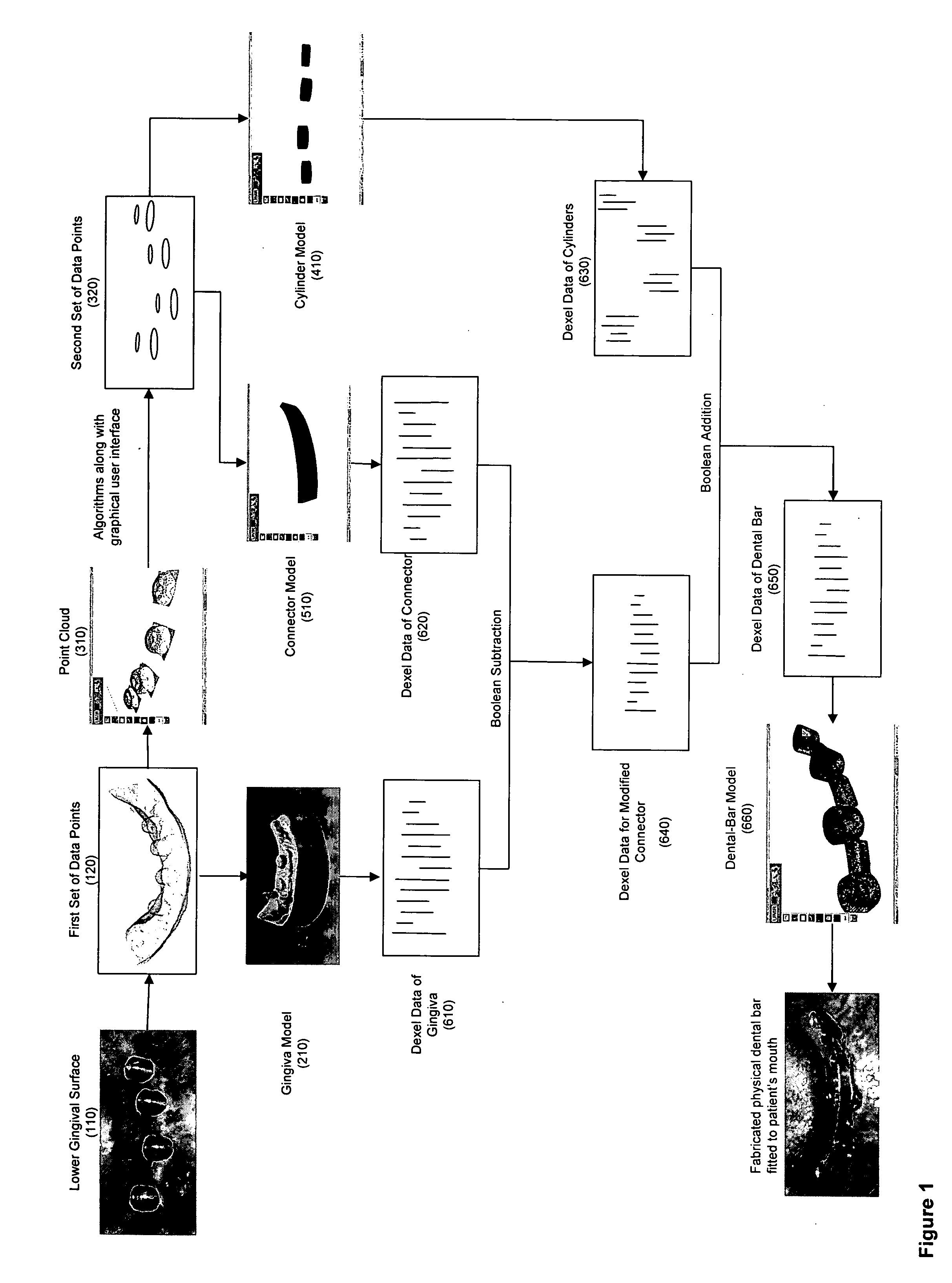 Computer aided dental bar design