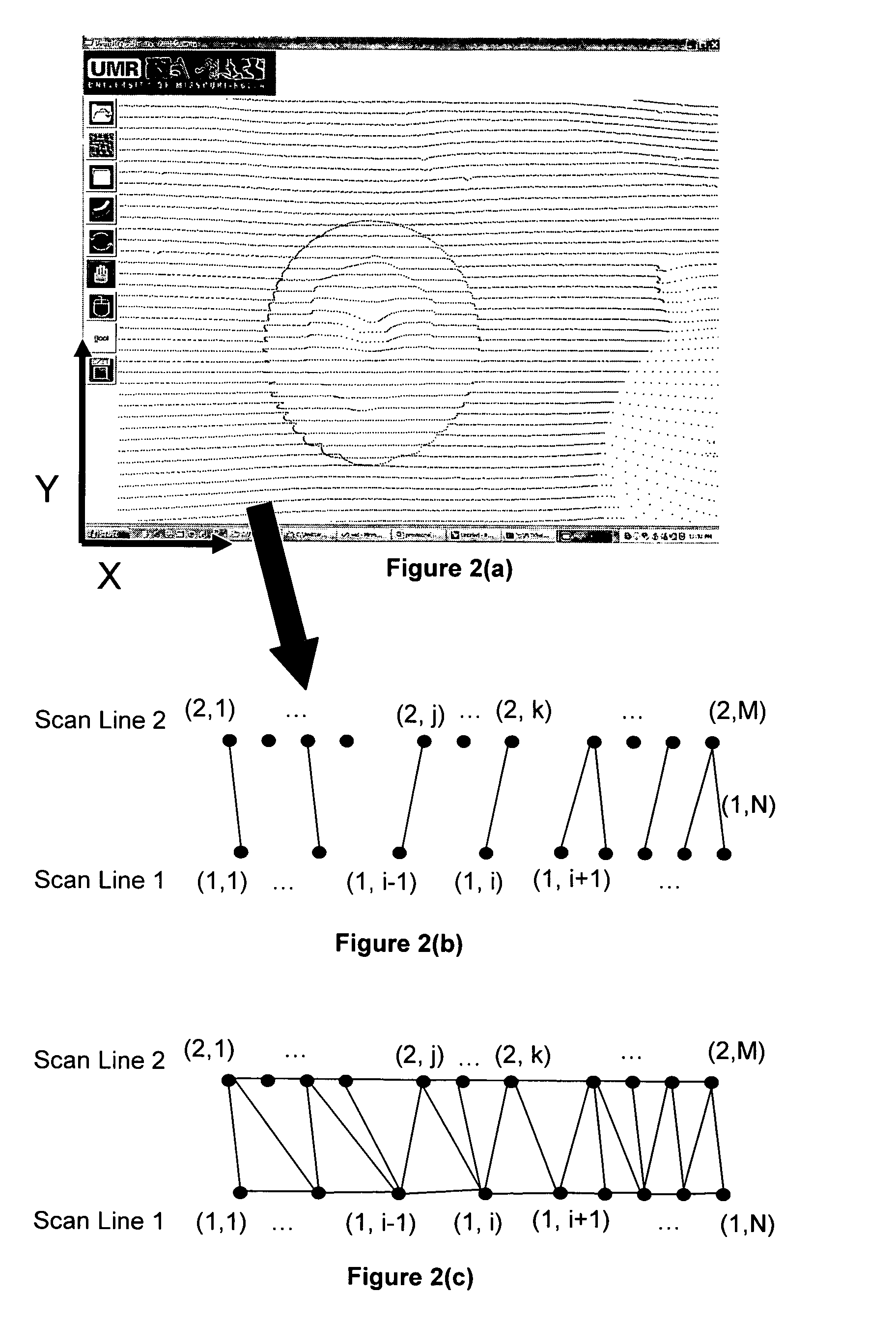 Computer aided dental bar design