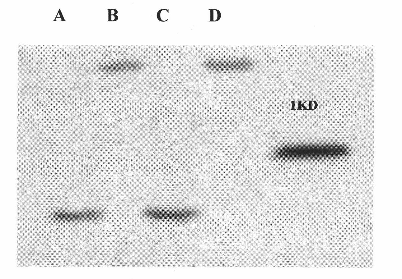 Anti-inflammatory antibacterial polypeptide capable of blocking combination of LPS and MD2