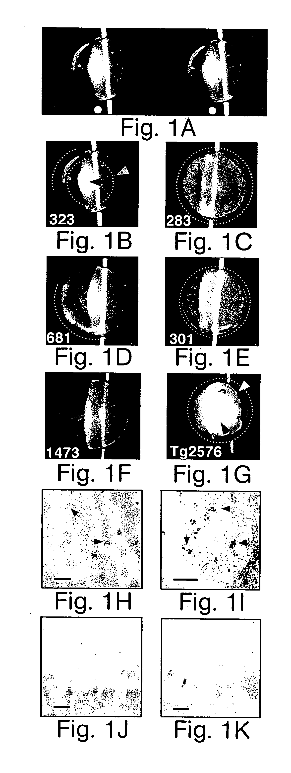 Methods for diagnosing a neurodegenerative condition