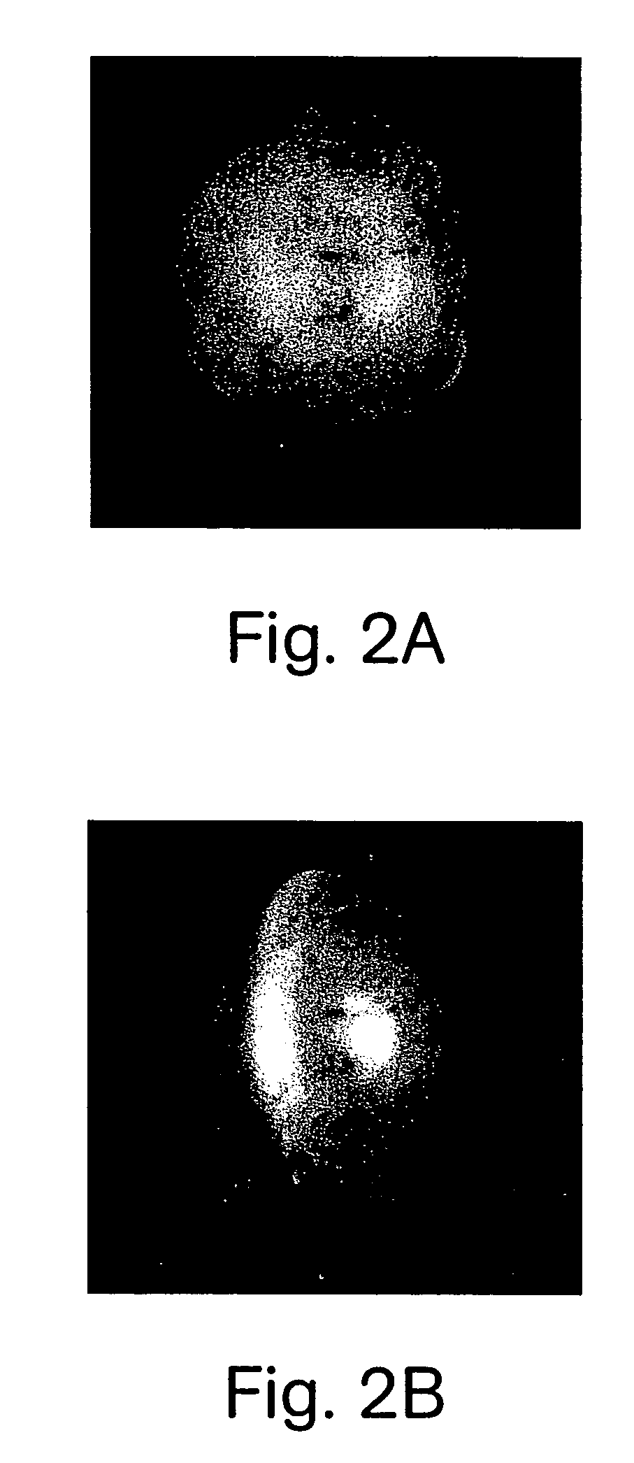 Methods for diagnosing a neurodegenerative condition