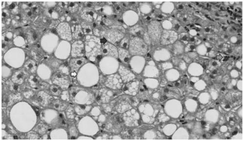 Feed for constructing nonalcoholic steatohepatitis model of nonhuman primates and application method of feed