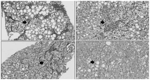 Feed for constructing nonalcoholic steatohepatitis model of nonhuman primates and application method of feed