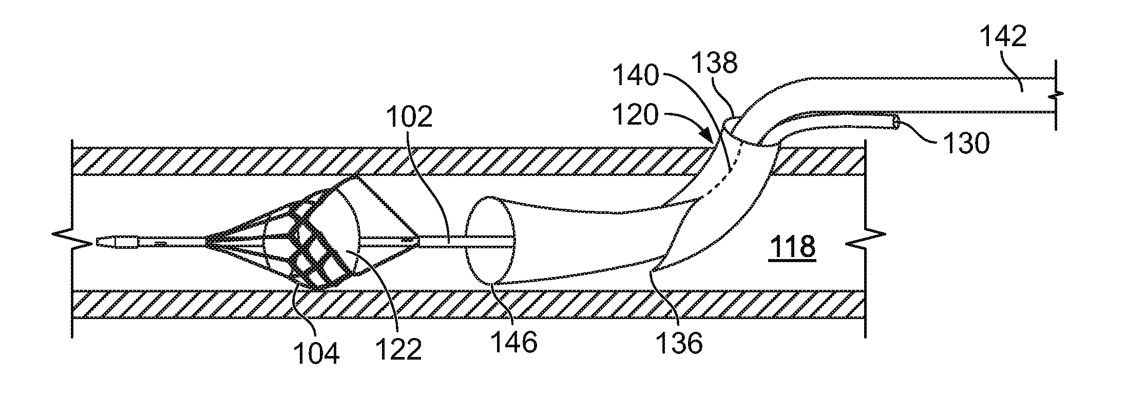 Temporary filter retrieval apparatus and method