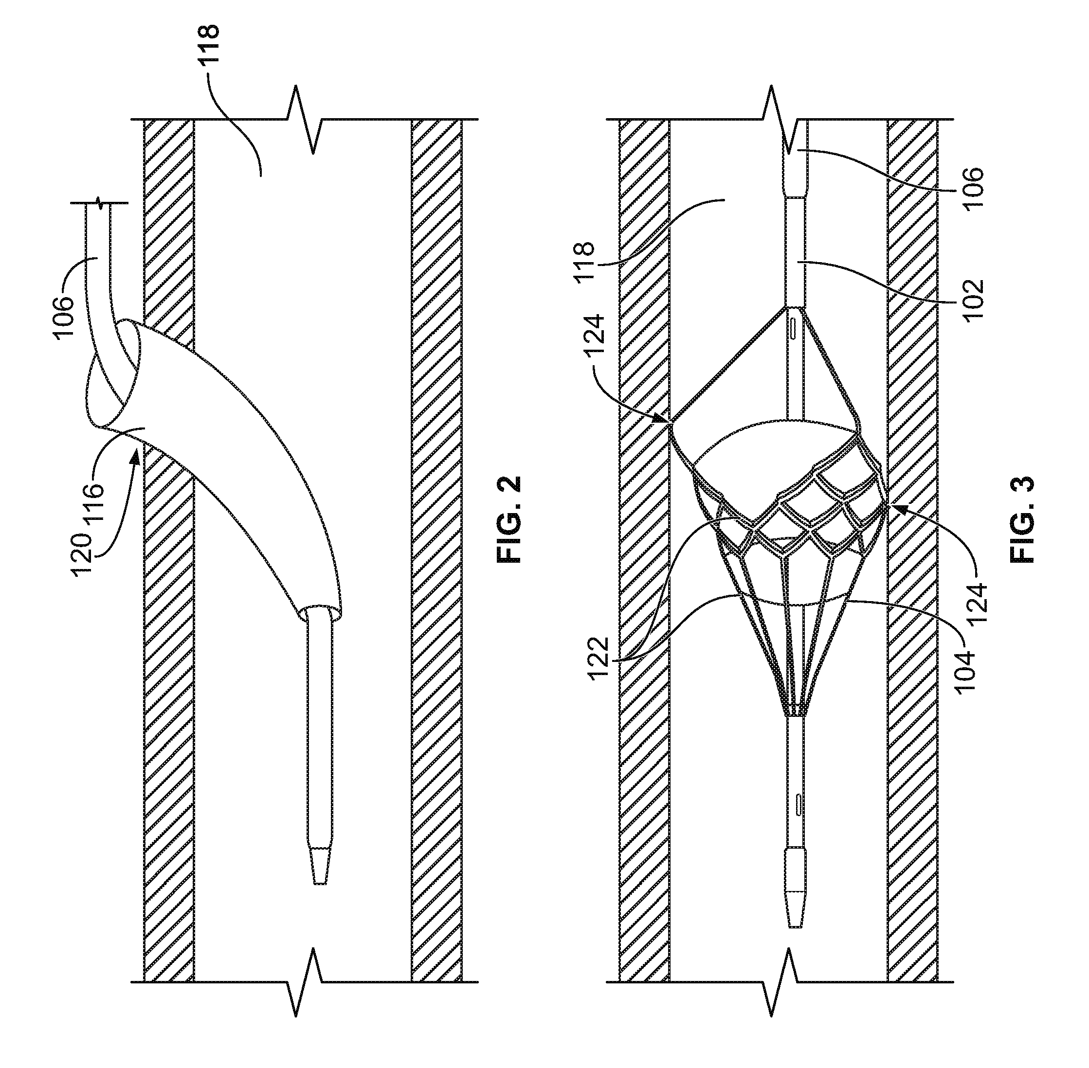 Temporary filter retrieval apparatus and method