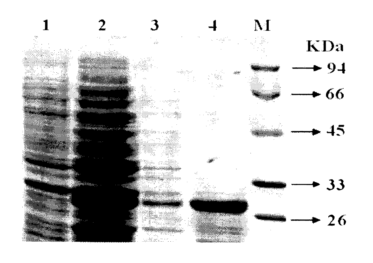 Halostachys caspica metallothionein gene as well as recombinant protein and application thereof