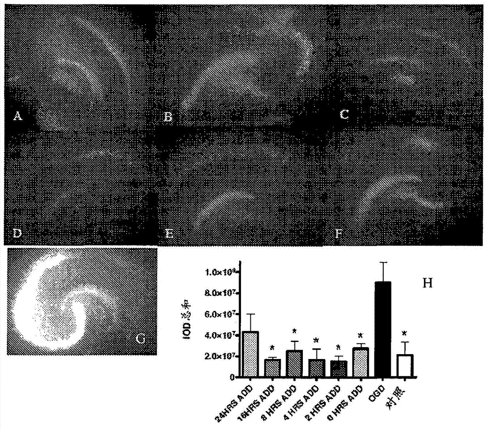 Method of reducing neuronal cell damage