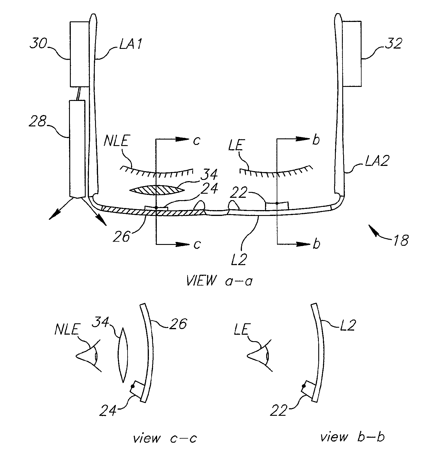 Method and system for treatment of visual impairment