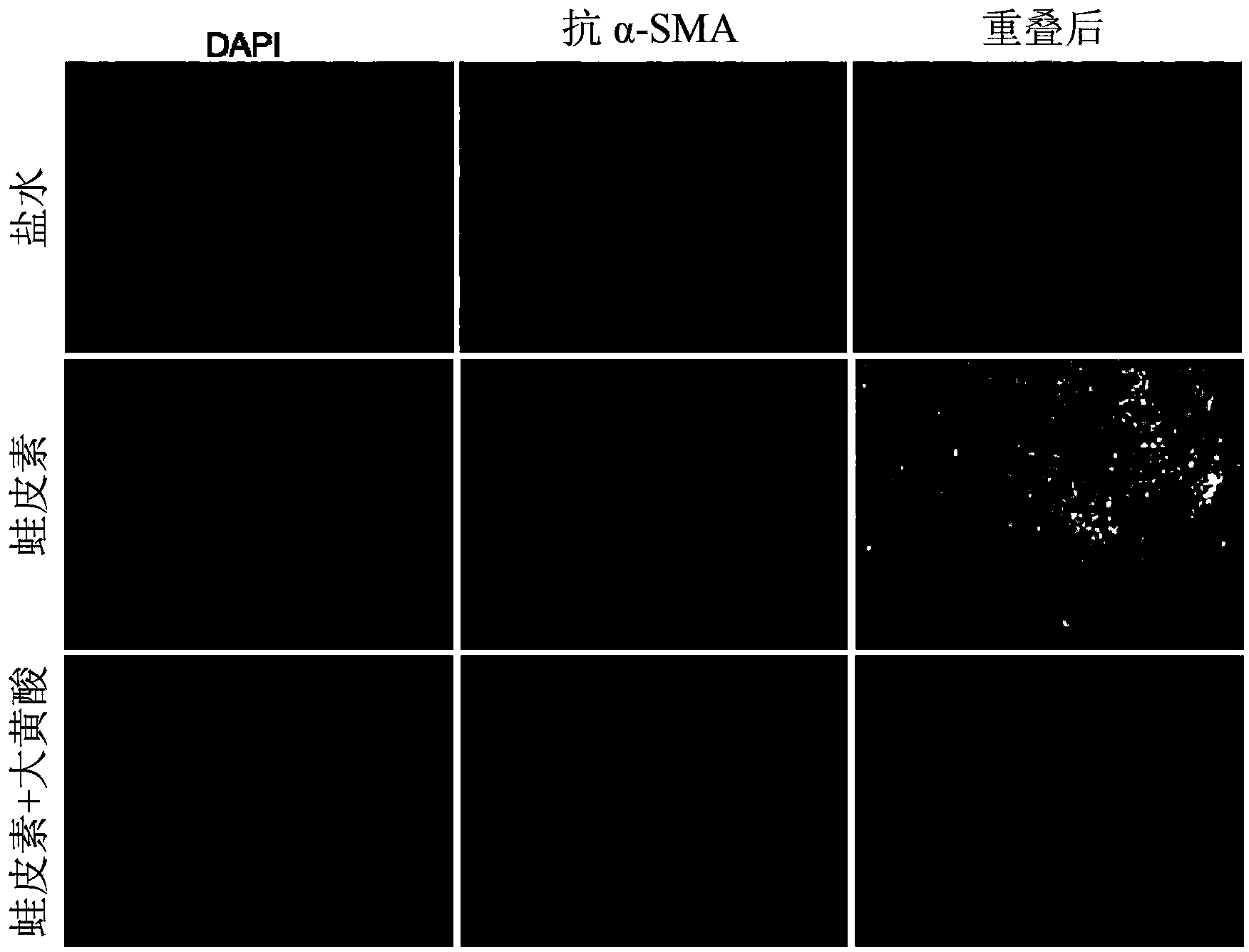 Method of using rhein for treating fibrotic conditions and tumors