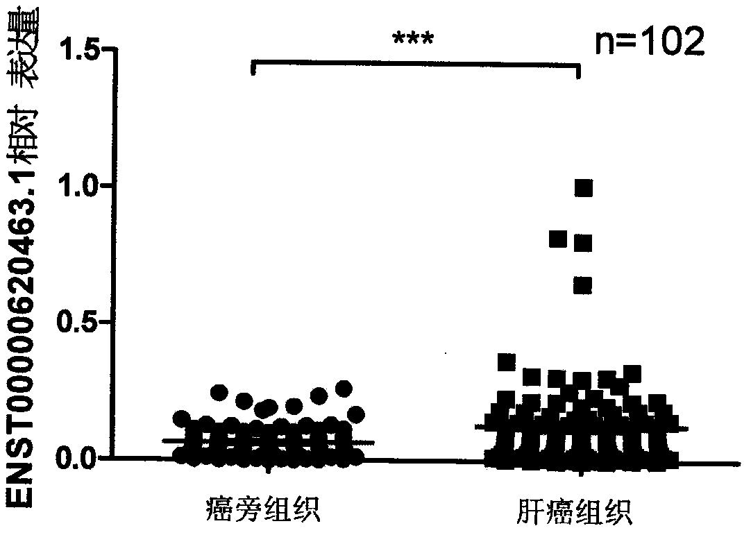 Liver cancer marker lncRNA ENST00000620463.1 and application thereof