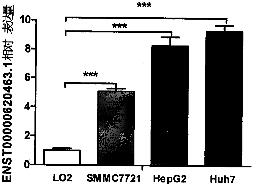 Liver cancer marker lncRNA ENST00000620463.1 and application thereof