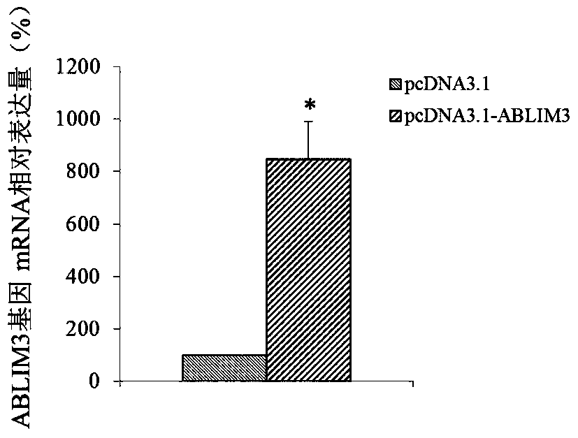 The use of ablim3 gene as a marker for the diagnosis and treatment of esophageal cancer