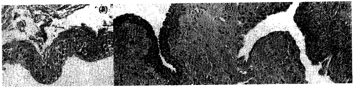 Gynostemma pentaphylla rinsing liquid with inhibitory effect on urothelium malignant potential proliferation, preparation method and application thereof