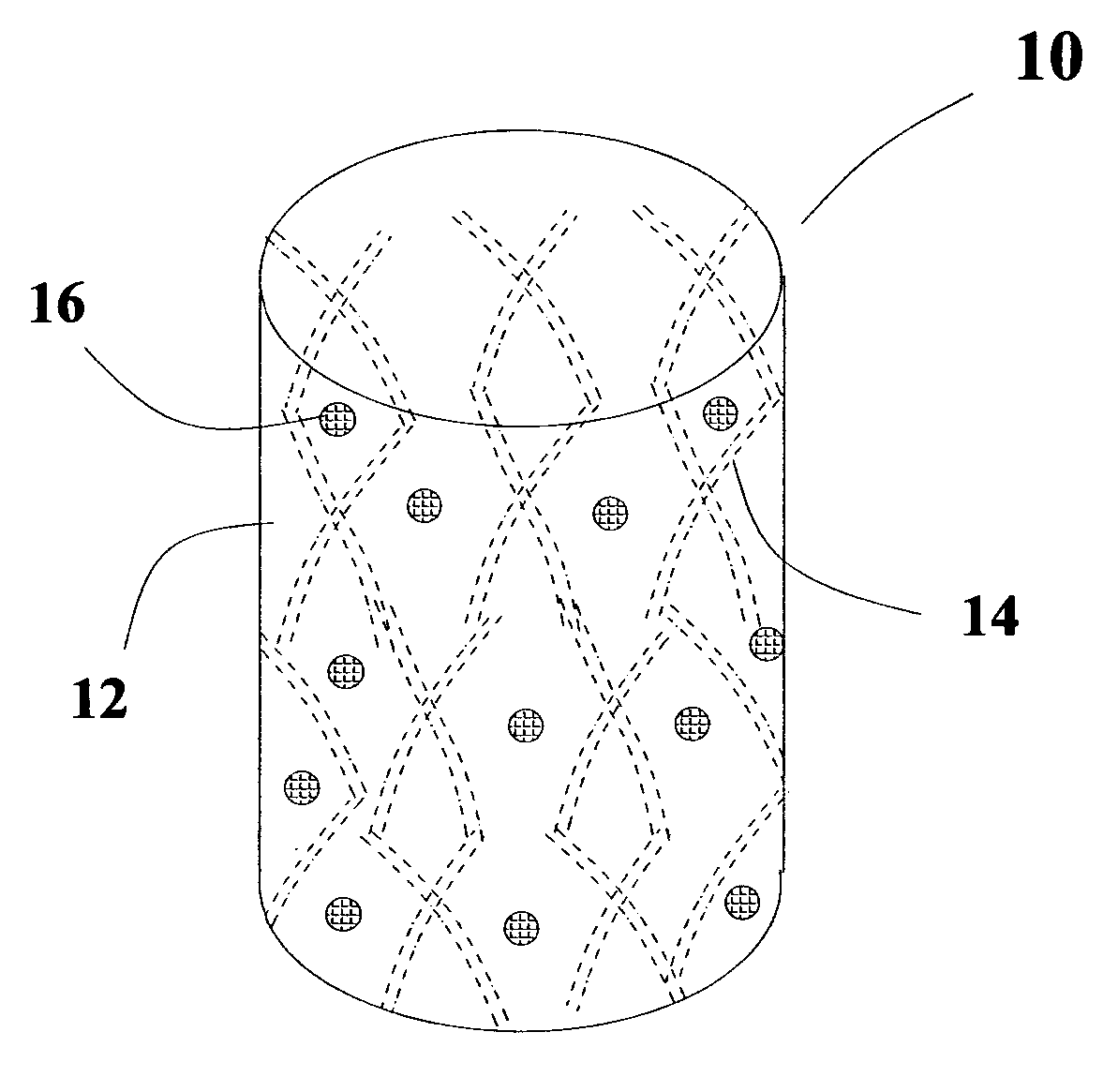 Methods and apparatus for in vivo cell therapy