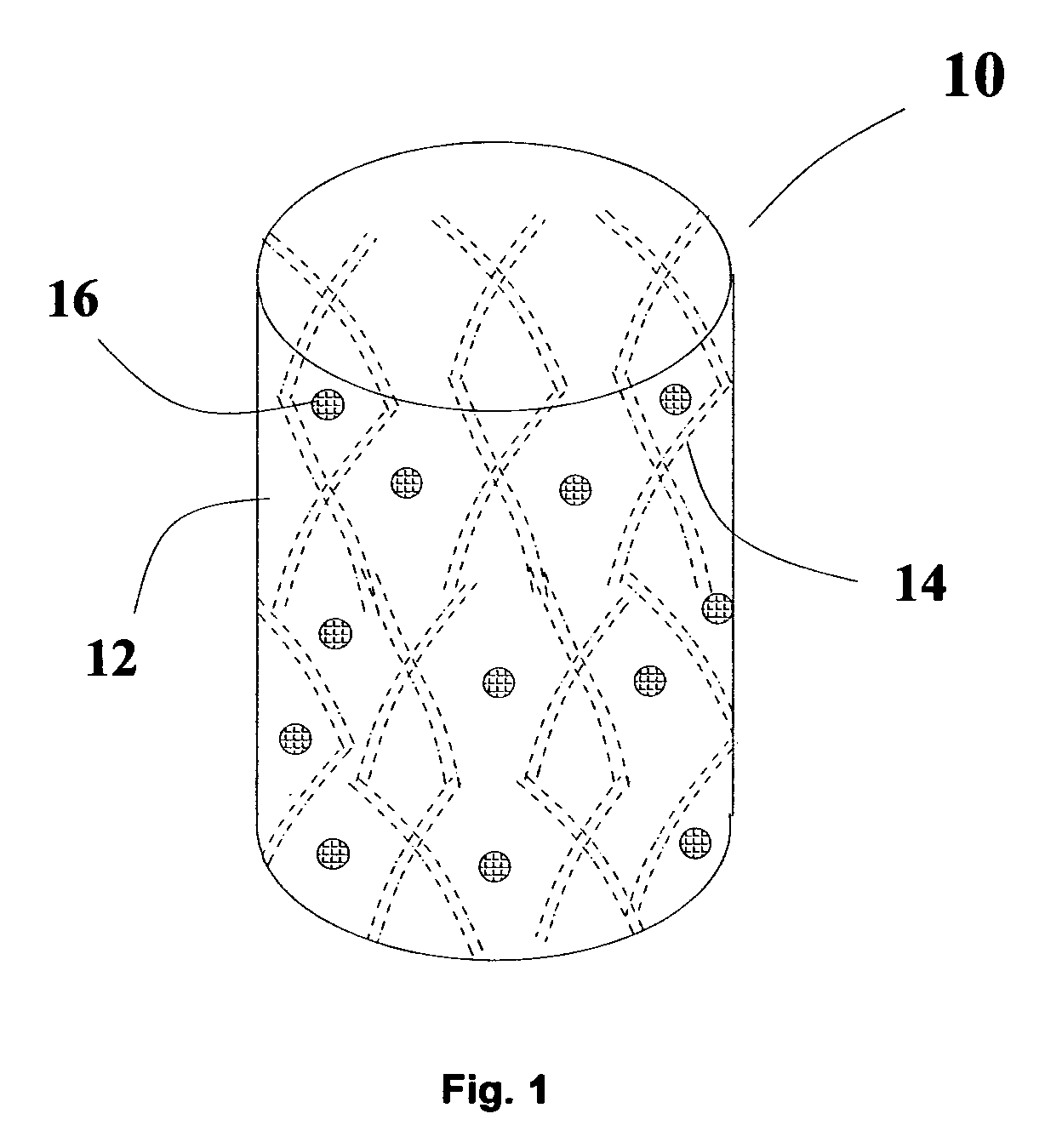 Methods and apparatus for in vivo cell therapy