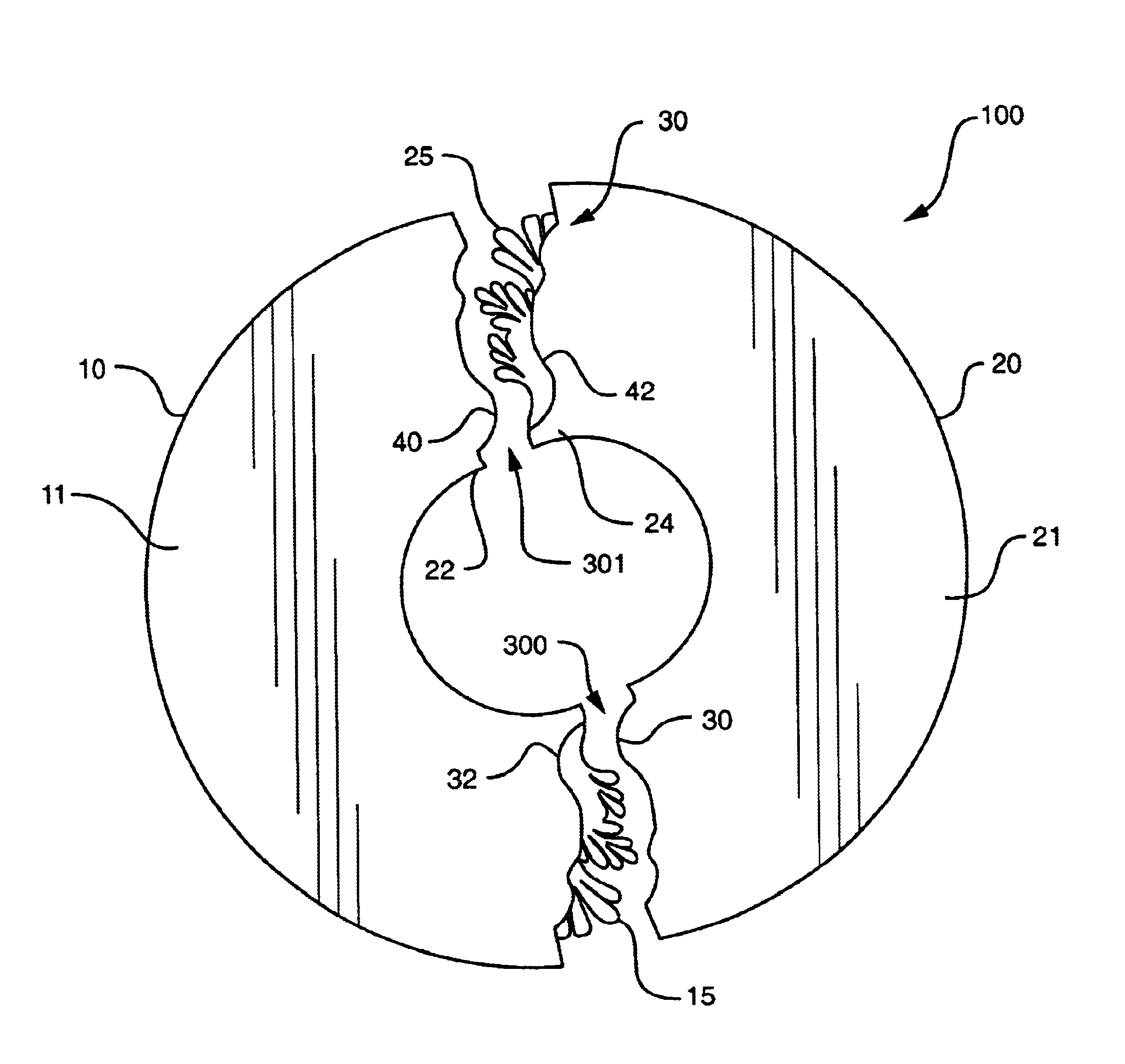 Two-piece decorative medallion