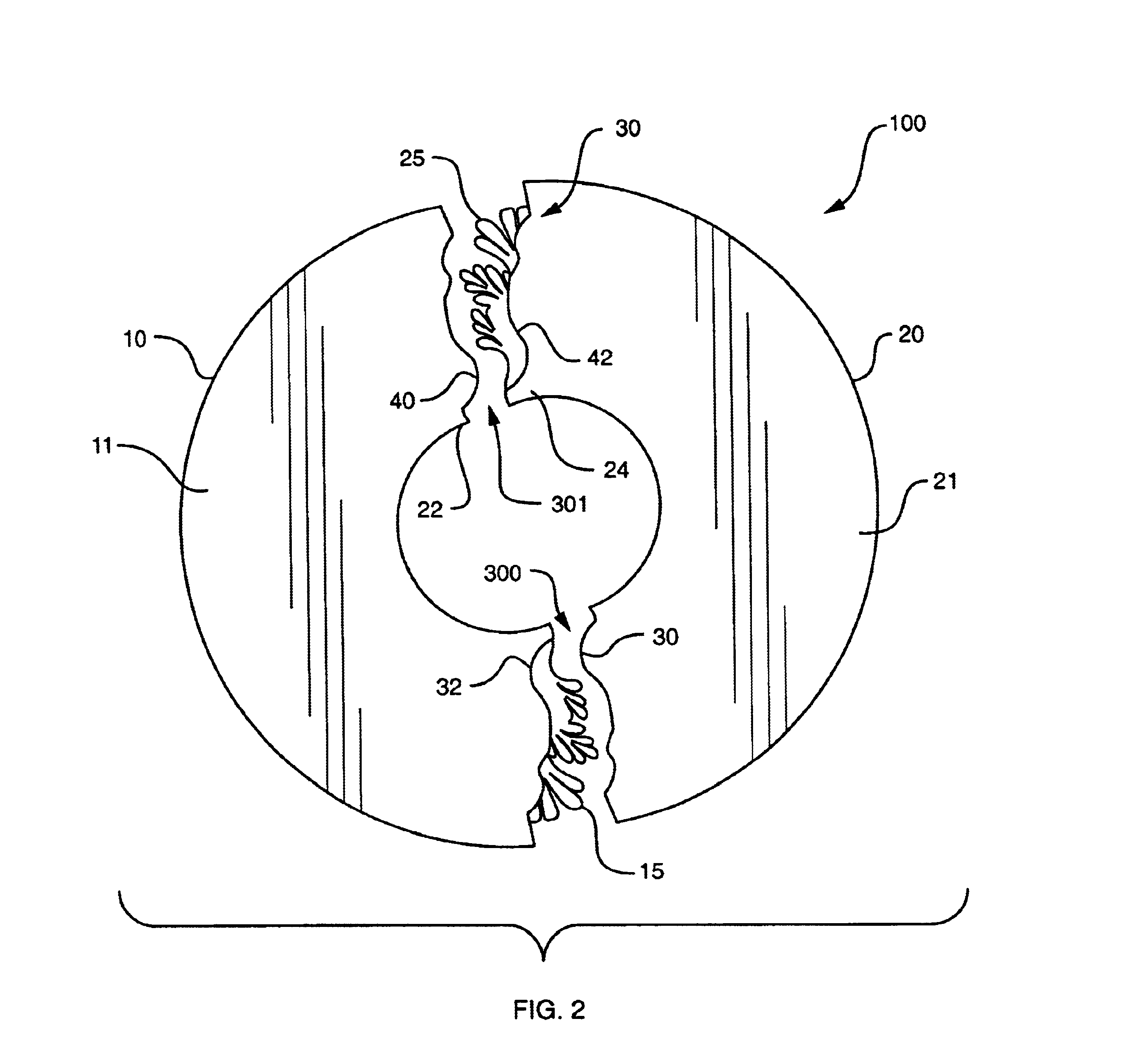 Two-piece decorative medallion