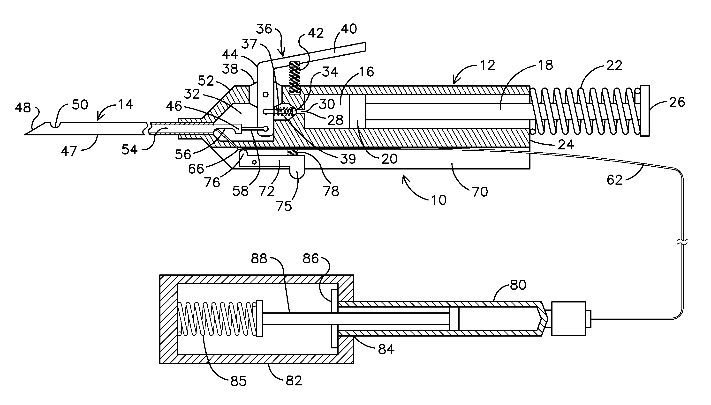 Retractable Tip For Vitrectomy tool