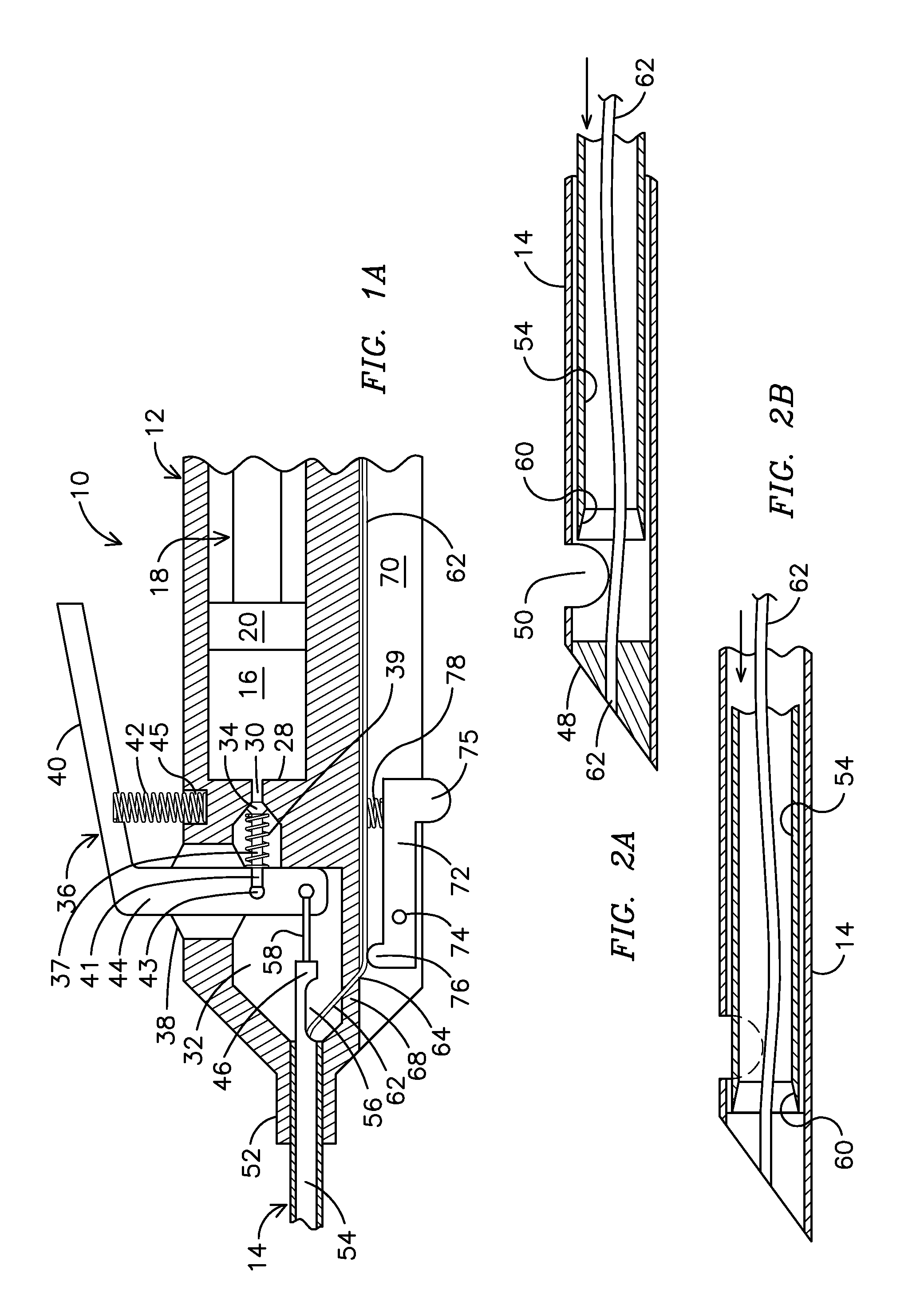 Retractable Tip For Vitrectomy tool