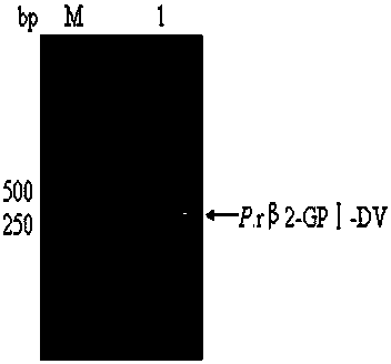 Yeast recombinant expression, purification and application of a protein functional polypeptide with the effect of preventing and treating atherosclerosis