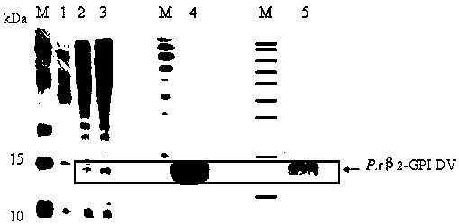 Yeast recombinant expression, purification and application of a protein functional polypeptide with the effect of preventing and treating atherosclerosis