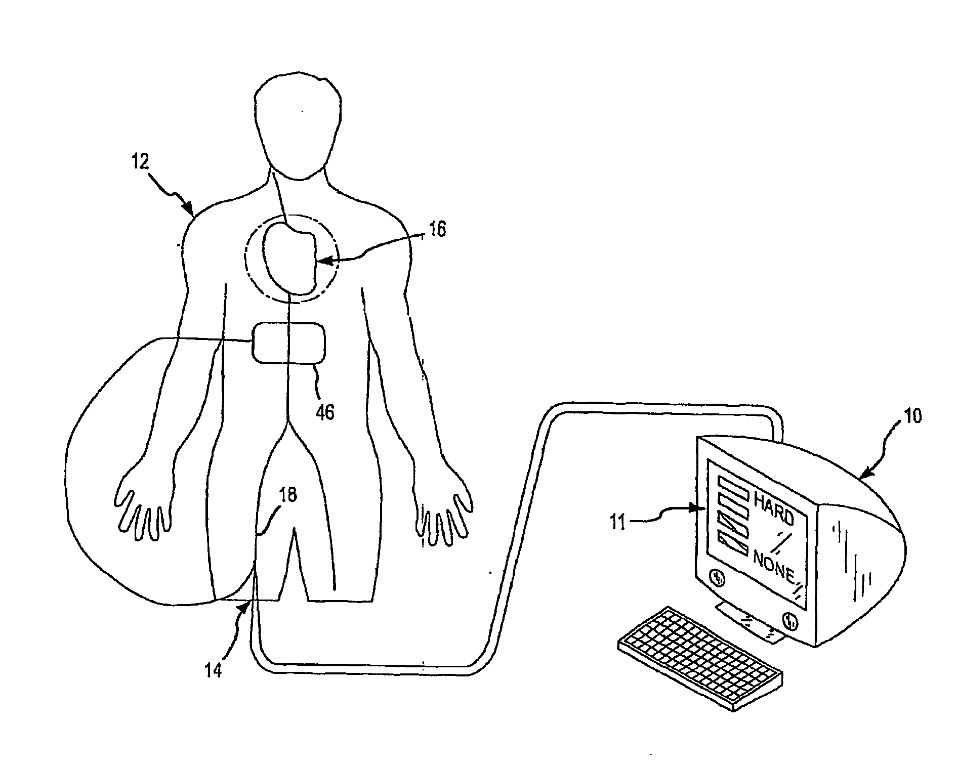 Assessment of electrode coupling for tissue ablation